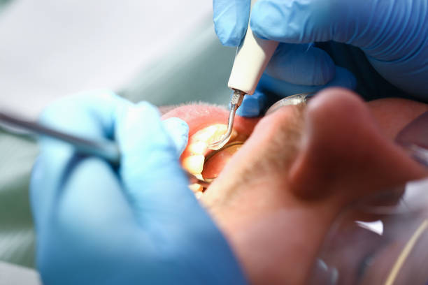 Best Emergency Dental Surgery in The Hills, NJ