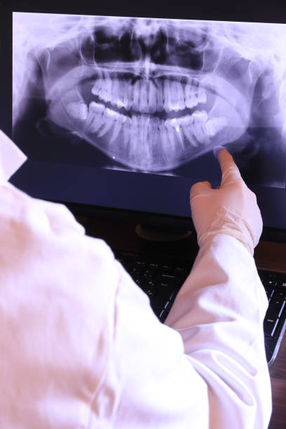 Best Emergency Tooth Extraction in The Hills, NJ
