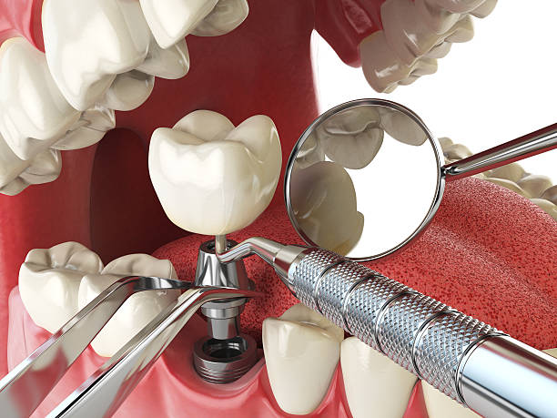 Best Emergency Treatment for Toothache in The Hills, NJ